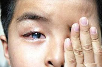 男人40一枝花 别让眼疾拖成瞎